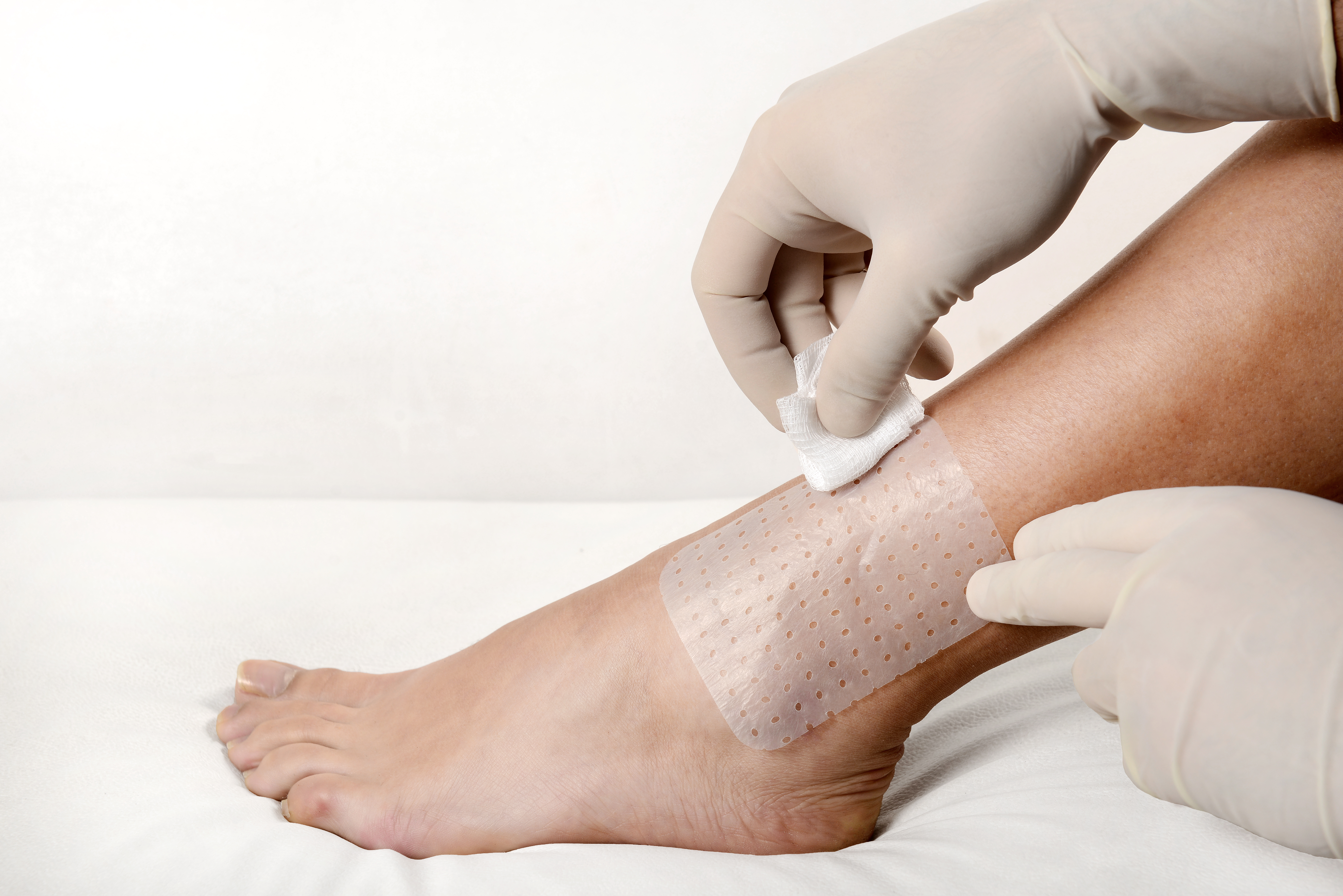 Membracel - 10x15 cm